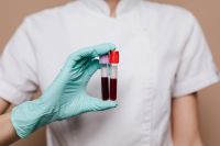 Kaboompics - Blood test result for the Coronavirus